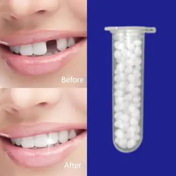 Laikinas dantų taisymas 5G dantų klijai saugūs